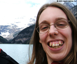 Marie-Hélène Cyr - Before orthodontic treatments and orthognathic surgeries (June 2005)